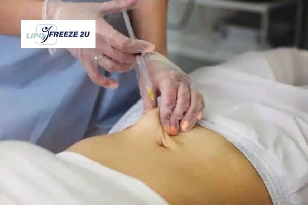 Fat Dissolving Injections Swanage & Weight loss medication