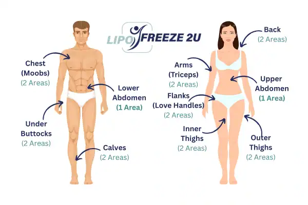 Areas you can have fat freezing treatment Swanage
