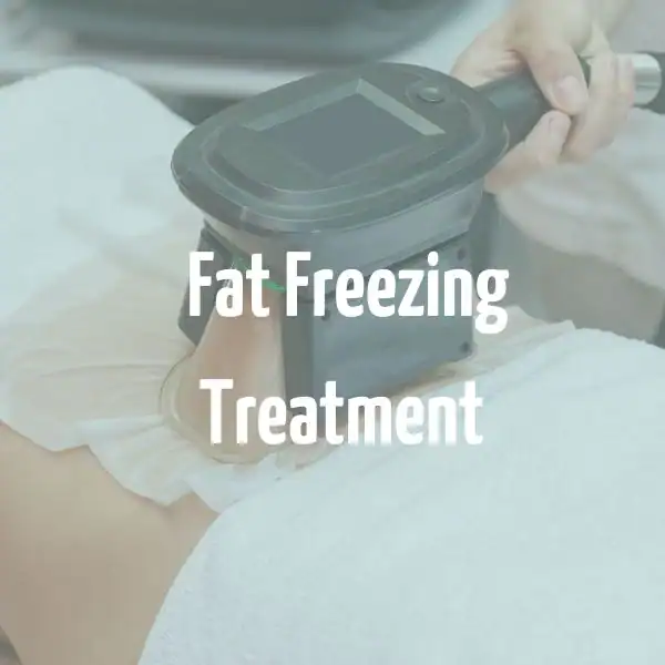 fat freezing treatment Swanage