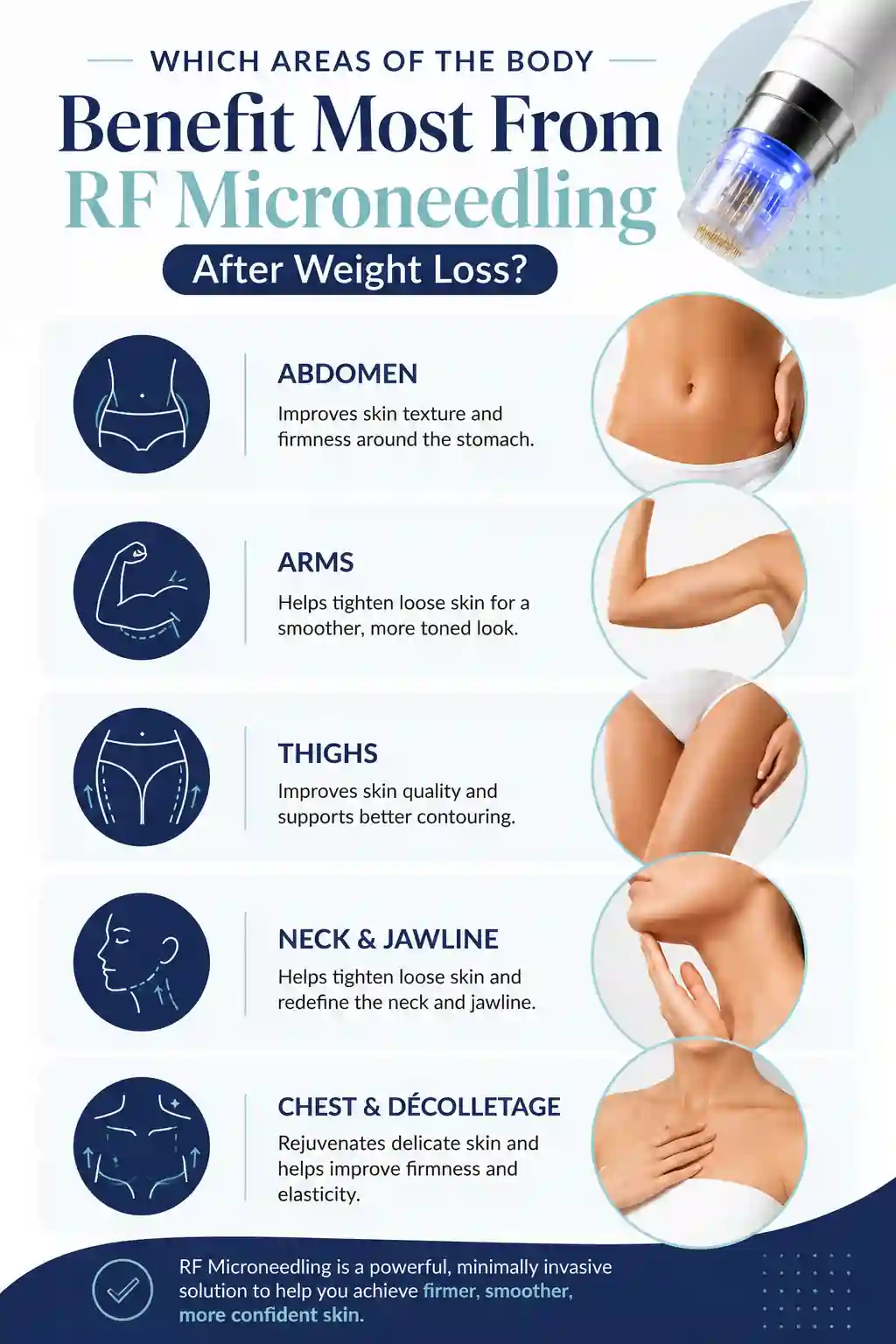 Which Areas of the Body Benefit Most From RF Microneedling After Weight Loss Swanage
